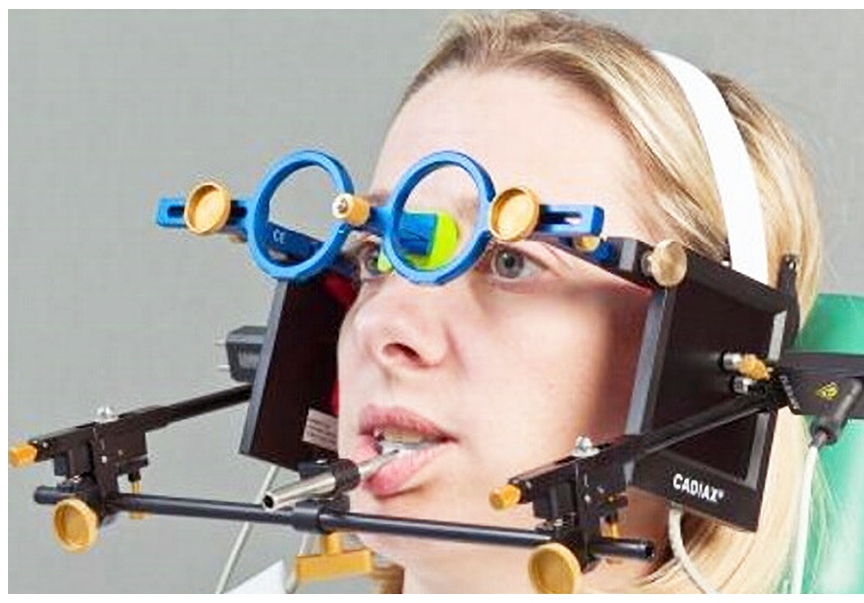 *