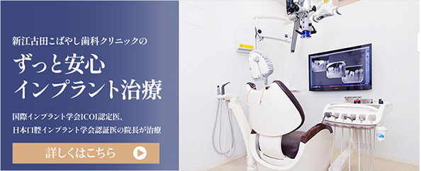 インプラント